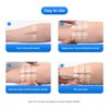 Longmed Emergency Wound Closures - 10 Pcs Zipper Wound Closure Device Painless Stitch Sutures Laceration Repair Without Stitches Adhesive Bandages for First Aid Wound Care