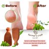 Natural Pumice Stone Made of Terra Cotta Remain 7+ Years | Ancient Indus Valley Foot Scrubber Callus Remover Skin Care Pedicure Tool for Cracked Heels & Dead Skin | Foot Exfoliator (+Organic Cocoa)