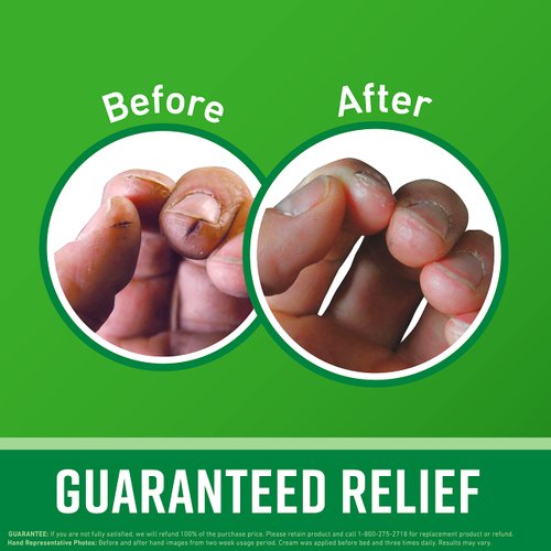 O'Keeffe's Working Hands Hand Cream; For Extremely Dry; Cracked Hands; 6.8 oz Jar (Value Size; Pack of 1)