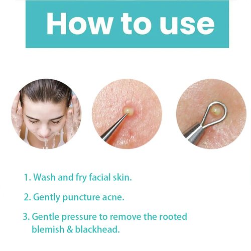 WQJifv Acne Patch Pimple Patch, 2 Size 288 Patches Acne Absorbing Cover Patch with Acne Needle, Hydrocolloid Invisible Acne Patches For Face Zit Patch Acne, Acne Spot Healing Patch Zit Patches