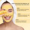 Turmeric Clay Stick Mask Organic Vitamin C Purifying Mask for Blackhead Cleansing Healing Clay Mud Mask for Deep Clean Pore Improve Skin Acne Scars Facial Mask With Blackhead Remover Extractor Tools