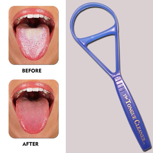 Tongue Scraper Cleaner - the Tongue Cleaner - End Bad Breath and Freshens Breath - Eliminate Bad Breath - Bad Breath Treatment (Color May Vary)