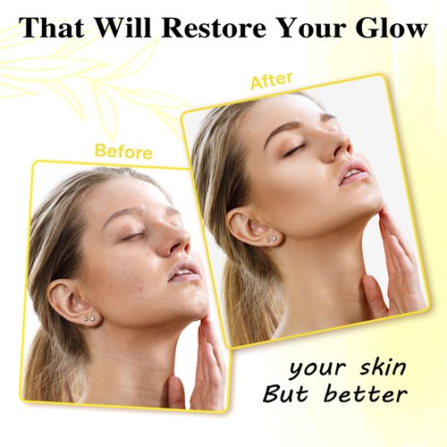 EUQEE Lemon Kojic Acid Soap, 5 oz Soap Bars with Vitamin C, Turmeric, Lemon, Vitamin E for Skin Beauty Remove Skin Impurities and Experience Deep Skin Cleansing with a Foaming Net - 142g x 2 Bars