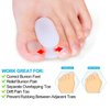 Povihome 10 Pack Gel Bunion & Toe Spacers Separators (0.3'' Thick) and Straightener Orthotics for Bunion Overlapping Toes, Bunion Toe Pain Relief - S Size