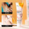 Vitamin C Skin Whitening Cream,Skin Bleaching Cream,Dark Spot Remover for Face,Skin Lightening Cream for Intimate Areas,Neck,Armpit,Elbow, Inner Thigh and Knees,Improve Underarm Dullness Odor
