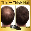 Hair Fibers for Thinning Hair and Refill (45g, Dark Brown) - Root Touch Up & Hair Powder For Gray Hair Cover Up - Instantly Thicker & Fuller Look - Completely Conceals Hair Loss in 15 Seconds