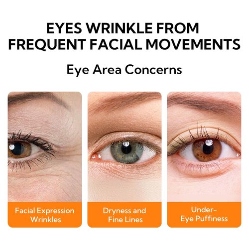 LANBENA Eye Cream for Wrinkles,Anti-Aging Eye Cream with Vitamin C,Reduce Fine Lines,Firm Eye Skin,Puffy Eyes and Dark Circles Treatments