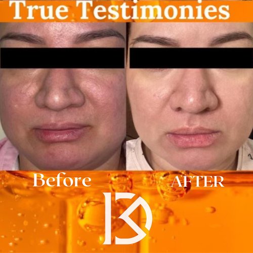 DR.MONCADA-Glycolic Acid Face wash-Exfoliating Facial Cleanser and Scrub, 10% Glycolic Acid, AHA and salicylic acid-blackhead remover, Pore Minimizer, Makeup Remover All In One, 5.07 Fl/Oz