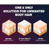 Epify Hair Removal Cream, Intimate Private Hair Removal Cream for Men and Women, Private Area, Pubic & Bikini Hair Removal Cream, Sensitive Skin, 8.45 Fl Oz
