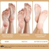 Berlaney Foot Peeling Mask - Pro Callus Remover with Coconut Extract for Rough Cracked Dry Feet - Dead Skin Remove, 3Pairs