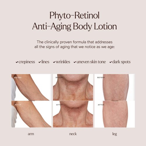 True Botanicals Phyto Retinol Anti-Aging Body Lotion | Targets Fine Lines, Wrinkles, Crepey Skin | Rosehip Oil & Peptilium | Dermatologist Tested, All Natural, Vegan | 4.3 oz | 127 ml
