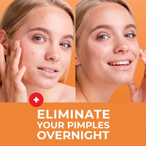 PatchRx Pimple Patches for Face (240 Patches), Hydrocolloid Acne Patches, Pimple Patch Pimple Stickers, Hydrocolloid Patch Acne Dots Acne Pimple Patches For Face, Zit Patches, Acne Spot Treatment