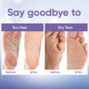 Foot Peeling Mask | Skin Care Pedicure Foot spa - Foot Mask & Foot Callus Remover with Aloe Vera Extract for Baby Soft Skin | Woman & Man | Remove Dead Skin, Cracked Feet & Callus | Lavender (2 Pairs)