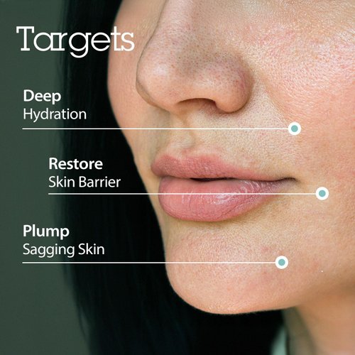 BLITHE Targeted Hydrating Serum with Hyaluronic Acid 2.0 - Deep Moisture, Skin Barrier Protection, Anti-Aging, Cruelty-Free, 50ml