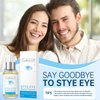 LA.PERSONAL Stye Eye Treatment, Chalazion Remover, Eye Serum for Styes Chalazion and Blepharitis Treatment, with Avocado oil, Sea buckthorn oil & Caffeine 1.01 Fl oz/30 Ml