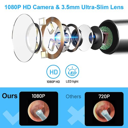 Ear Wax Removal, Earwax Remover Tool with 1080P HD, Waterproof, Easy Use, 3.5mm Ear Camera with 6 LED Lights, Earwax Removal Tools for ios & Android, Kids & Adults
