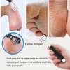 Ingrown Toenail Clippers Thick Nail Tool Kit Pedicure Knife Nail Pliers Nail Lifter Treatment Nail Cutter Cuticle Manicure Kit Foot Care Tools Toe Nail File