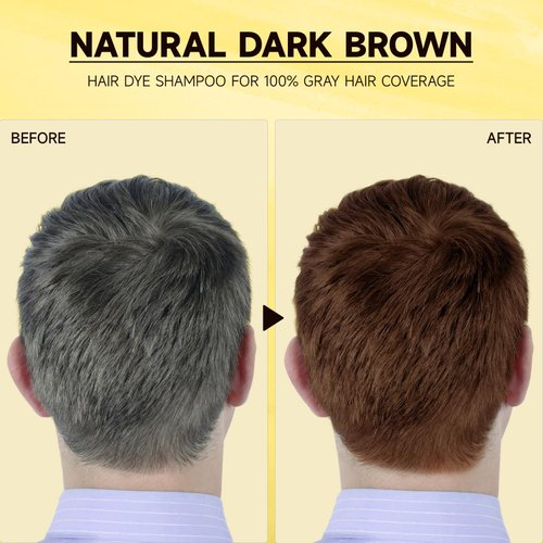 Dark Brown Hair Dye Shampoo for Gray Hair Coverage and Color Control - Herbal 3 in 1 for Men/Women, Ammonia-Free