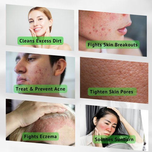 iMMense Naturals Aloe Vera Toner for Face. Skincare to Treat and Prevent Acne, Restore PH Balance & Excess Dirt. Facial Toner for Women and Men.