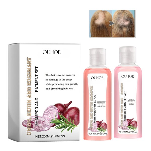 Onion Biotin and Rosemary Shampoo & Conditioner Hair Care Set, for All Hair Types