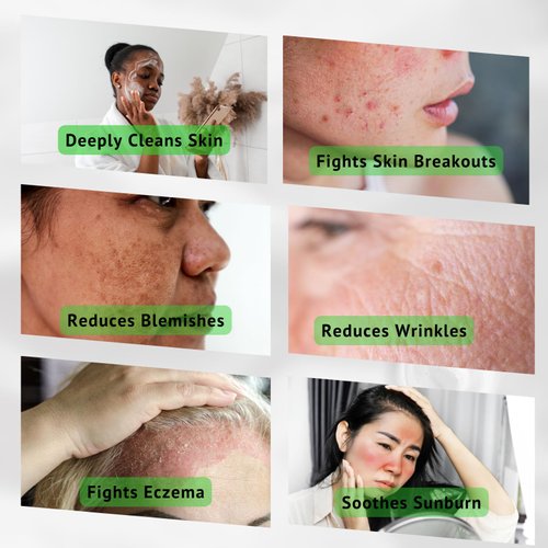 iMMense Naturals Aloe Vera Gel Cleanser, For Dry & Oily Skin. Treat & Prevent Acne, Dark Spots & Eczema. Face Wash for Men and Women.