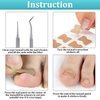 122 Pieces Ingrown Toenail Tool Set, Include Ingrown Toenail File and Lifter, 60 Pieces Elastic Patch Curved Toenails Brace Stickers and 60 Pieces Ingrown Toenail Correction Stickers
