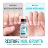 Stop Nail Biting Treatment - Clear, Bitter-Tasting Nail Polish To Stop Nail-Biting - Easy To Apply and Safe For Children - Nail Strengthener Solution - Nail Care for Healthy Nail Growth (0.5 fl oz)