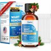 Ragkun Fast-Acting Skin Tag Remover Wart Remover with Salicylic Acid, Wart Removal for Women Men, Wart Freeze Off for Plantar Wart,Flat,Common, Corn,H Wart, Callus 30ML