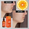 Vitamin C Face Serum - Antioxidant - Moisturizes and Fades Acne Scars - Face Serum for Women - Made with Natural Ingredients - For Face Care - 60ml 02 OZ