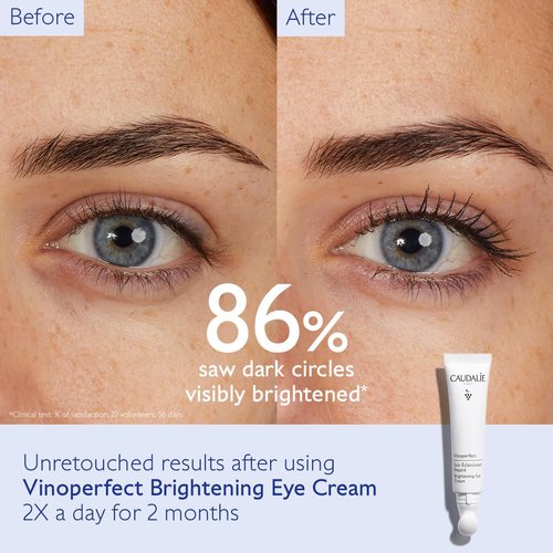 Caudalie Vinoperfect Dark Circle Brightening Eye Cream with Niacinamide - Visibly Brightens, Evens Under-Eye Texture and Hydrates the Eye Contour