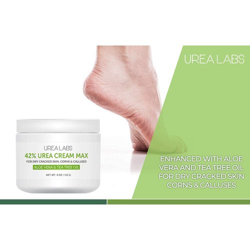 UREA LABS | 42% Urea Cream MAX w/Aloe Vera & Tea Tree Oil, 4 Oz Highest Potency Foot Cream, Corn & Callus Remover. Moisturizes & Re-hydrates Rough, Cracked, Dead & Dry Skin on Feet, Elbows and Hands