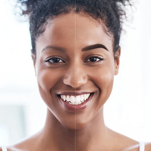 iMethod Eyebrow Stamp and Eyebrow Stencil Kit - Eyebrow Stamp and Shaping Kit for Perfect Brow, Eye Brow Shaping Kit, Long-lasting, Dark Brown