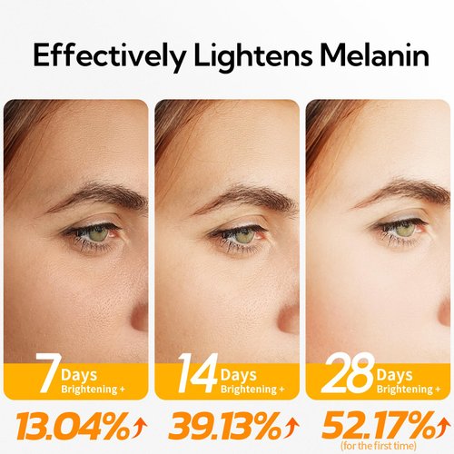 20% Vitamin C Serum For Face, 30 ML/ 1 Fl, Brightening Skin, Dark Spot Remover, Reduce Wrinkle, Anti Aging Glowing Serum, Facial Moisturizer with Niacinamide, Vitamin E, Hyaluronic Acid