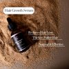 JY Perfection Hair Serum, Hair Growth, Treat Damaged Hair, Stronger Hair, Natural DHT Blockers, 100% Natural Ingredients, Caffeine, Saw Palmetto, Rosemary, Ginger, Mint, Castor Oil, Vitamin E, 30ml,
