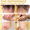 Rida Hair Research Institute Psoriasis Cream for Itchy Scalp, Face & Body | Eczema Cream for Adults | Psoriasis Treatment for Skin | Itching, Irritation & Redness Relief | XL Size