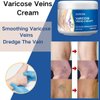 Uioecn 2Pcs Varicose Veins Cream, Skin Cream for Legs, Spider Varicose Veins ReliefCream