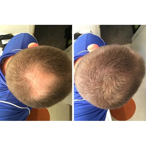 Caboki Hair Concealer (All-Natural Hair Building Fibers) Travel Size (Light Brown)