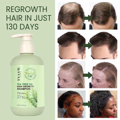 JINGDAIBURY Rosemary Hair Growth Shampoo 3-In-1, Tea Tree Thickening Shampoo for Hair Regrowth, Strengthening Mint Biotin Shampoo for Thinning Hair and Hair Loss Soothes Scalp for Men & Women, 300ml
