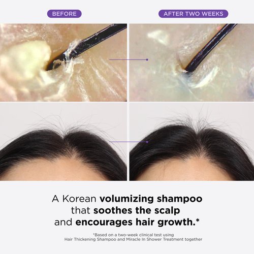 Dr. Groot Hair Thickening Shampoo for Hair Loss, Korean Hair Care with Biotin, Rosemary Oil to help Volumize Thinning, Damaged Hair, Hydrate Hair and Scalp, Biotin Shampoo,Scalp Revitalizing Solution