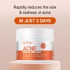 Acne Treatment for Face, Acne Cream Back Acne Treatment Cream for Teens & Adults Anti-acne Moisturizer Pimple Cream Butt Acne Clearing Cream, Acne Spot Treatment for Breakouts Blemish 30g