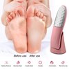 Foot Scrubber with Stand, Never-Cut-Your-Feet Foot File Callus Remover - Safe to Use | Comfortable Foot Scraper Feet Scrubber Dead Skin Remover, Best Home Pedicure Foot Care Tool, Used on Wet/Dry Feet