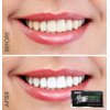 MagicBrite Bamboo Charcoal Teeth Whitening Strips At Home Whitening Kit