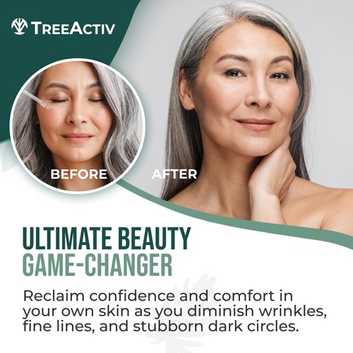 TreeActiv Anti Deep Wrinkle Serum, Vitamin C Serum for Face with Hyaluronic Acid, Retinol Serum for Face for Skin Elasticity, Fine Lines, and Dark Spots, Wrinkle Serum, 60-Day Supply