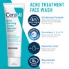 CeraVe Acne Skin Care Set, 5oz Acne Foaming Cream Cleanser + 1oz Resurfacing Retinol Serum + 2oz AM Facial Moisturizing Lotion with SPF 30 + 2oz PM Facial Moisturizing Lotion, Skin Care Gift Sets