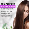 Hair Fibers for Thinning Hair for Women - Dark Brown - 27.5g Hair Building Fibers - Instantly Conceals Hair Loss - Revitalize Your Hair, Unlock Thicker, Fuller Tresses
