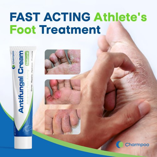 CHARMPOO Antifungal Cream for Foot and Body: Fast Relief Athlete's Foot Jock Itch Psoriasis Ringworm Eczema Rashes - Powerful Herbal and Miconazole Formula 30g(Pack of 1)