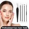 FVION Blackhead and Acne Extractor Kit, Professional Pimple Popper Tool Kit, Acne Tweezers and Blackhead Remover Tools for Face, 5 PCS Surgical Extractor Pimple Popping Tools