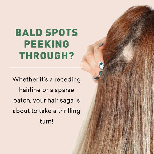 Bald Spot Hair Growth Cream | Scalp Treatment for Receding Hair | For Men and Women | Just Nutritive | 4 Oz