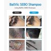 BallVic Sebo Shampoo - Itchy Scalp Trouble Care Dandruff Treatment Hair Loss Shampoo for Seborrheic Dermatitis Eczema Men and Women 2.8 Oz (500g)