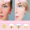 QIAOMU anti-acne patch can cover facial blemishes, suitable for facial spots and acne marks, 6 patterns of star patches 216 pieces